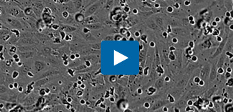 Visualize transendothelial migration: leukocyte extravasation across an endothelial cell monolayer