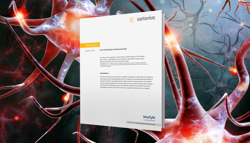 Blog - White Paper: Live-cell Analysis for Neuroscientists