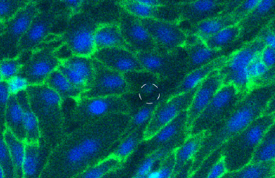 Visualize transendothelial migration using immunofluorescence staining