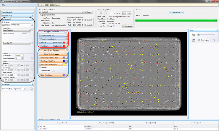 Chemotaxis Migration (Top/Bot) Processing Definition Editor - FLUORESCENCE